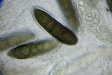 Massaria inquinans image