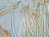 Sarcoscypha austriaca image