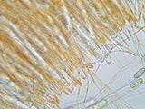 Sarcoscypha austriaca image