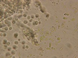 Hyphoderma roseocremeum image