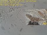 Julella vitrispora image