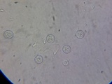 Pseudoplectania nigrella image