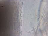 Pseudoplectania nigrella image