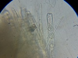 Pseudoplectania nigrella image