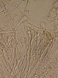 Coprotus vicinus image