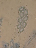 Coprotus vicinus image