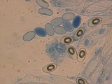 Coprotus vicinus image
