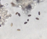 Psathyrella bipellis image