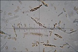 Anthostoma decipiens image