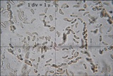 Anthostoma decipiens image