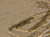 Sporormiella lageniformis image