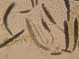 Sporormiella lageniformis image