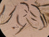Sporormiella lageniformis image