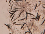 Sporormiella lageniformis image