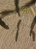 Sporormiella lageniformis image
