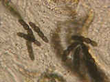 Sporormiella lageniformis image