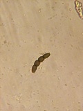 Sporormiella lageniformis image