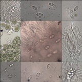 Caloplaca teicholyta image
