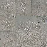 Caloplaca teicholyta image