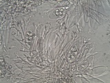 Caloplaca teicholyta image