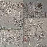 Fulgensia fulgens image