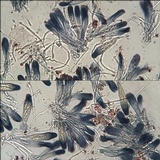 Fulgensia fulgens image