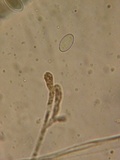 Peziza violacea image