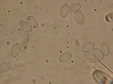 Peziza violacea image