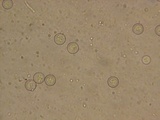 Plicaria endocarpoides image