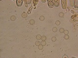Plicaria endocarpoides image