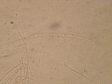 Pulvinula archeri image