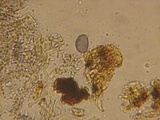 Aleurodiscus farlowii image