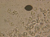 Podospora eminens image