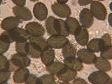 Podospora eminens image