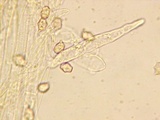 Nolanea holoconiota image