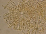 Orbilia delicatula image