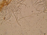 Hypomyces aurantius image