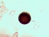 Thelomma occidentale image