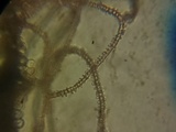Arcyria denudata image