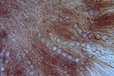 Pseudoplectania vogesiaca image