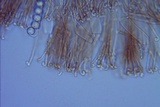 Pseudoplectania vogesiaca image