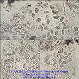 Verrucaria calciseda image
