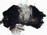 Pertusaria pustulata image