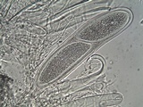 Pertusaria pustulata image