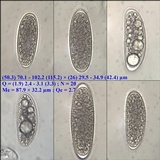Pertusaria leioplaca image