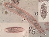 Pertusaria leioplaca image