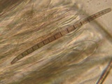 Trichoglossum hirsutum image