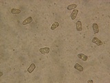 Inocybe chelanensis image