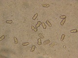 Inocybe chelanensis image