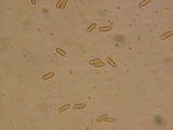 Ramaria coulterae image